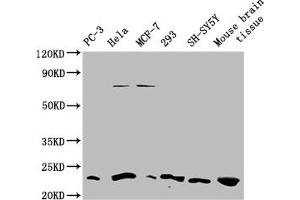 Western blot All lanes: TMEM65 antibody at 1. (TMEM65 antibody  (AA 63-240))