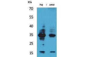Western Blotting (WB) image for anti-Interleukin 4 (IL4) (Internal Region) antibody (ABIN3187690) (IL-4 antibody  (Internal Region))
