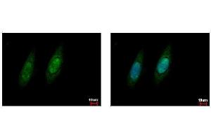 ICC/IF Image VCP antibody detects VCP protein at cytoplasm and nucleus by immunofluorescent analysis. (VCP antibody  (C-Term))