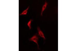 ABIN6278569 staining  HepG2 cells by IF/ICC. (FAF1 antibody  (C-Term))