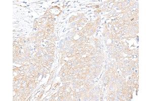 Immunohistochemistry (IHC) image for anti-Vinculin (VCL) (AA 1016-1066) antibody (ABIN7454836)