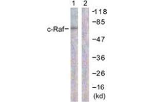 Western blot analysis of extracts from 293 cells, treated with PMA 125ng/ml 30' , using C-RAF (Ab-296) Antibody. (RAF1 antibody  (AA 271-320))