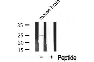 Claudin 2 antibody  (C-Term)