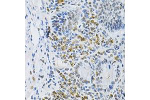 Immunohistochemistry of paraffin-embedded mouse stomach using SMARCE1 Antibody (ABIN5973097) at dilution of 1/200 (40x lens). (SMARCE1 antibody)