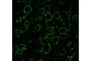 Presynaptic immunostaining of the calyx of Held in the medial nucleus of the trapezoid body (MNTB; dilution 1 : 1000). (SNAP91 antibody  (AA 279-297))