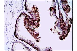 Immunohistochemistry (IHC) image for anti-Hyaluronan Synthase 3 (HAS3) antibody (ABIN1845757) (HAS3 antibody)