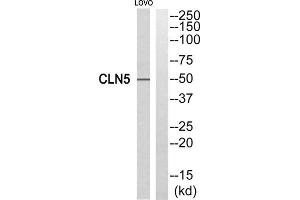 Western blot analysis of extracts from LOVO cells, using CLN5 antibody.