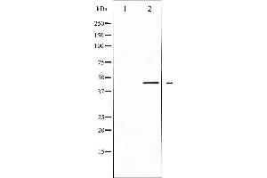 Western blot analysis of extracts from COS-7 cells, using CALR antibody. (Calreticulin antibody  (N-Term))