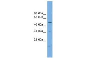 Image no. 1 for anti-Arrestin, beta 1 (ARRB1) (C-Term) antibody (ABIN6744484) (beta Arrestin 1 antibody  (C-Term))