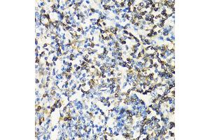 Immunohistochemistry of paraffin-embedded human tonsil using CD3E antibody (ABIN5970879) at dilution of 1/100 (40x lens).