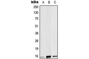 Western blot analysis of IL-9 expression in HEK293T (A), mouse heart (B), rat heart (C) whole cell lysates. (IL-9 antibody  (Center))