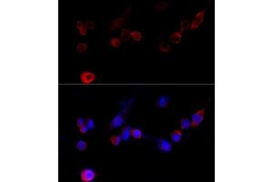 Immunofluorescence analysis of NIH/3T3 cells using Filamin A antibody (ABIN7267206) at dilution of 1:100 (40x lens). (Filamin A antibody  (C-Term))