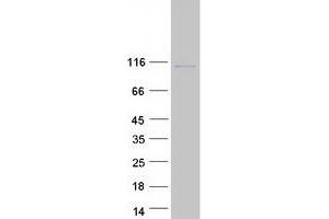 Validation with Western Blot (NVL Protein (Transcript Variant 1) (Myc-DYKDDDDK Tag))