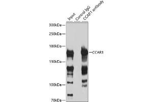 Immunoprecipitation analysis of 200 μg extracts of HeLa cells using 3 μg CC antibody (ABIN6129224, ABIN6138030, ABIN6138032 and ABIN6217655). (CCAR1 antibody  (AA 1-200))
