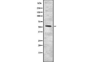 Western blot analysis of INAR2 expression in HEK293 cells ,The lane on the left is treated with the antigen-specific peptide. (IFNAR2 antibody  (C-Term))