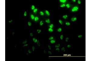 Immunofluorescence of monoclonal antibody to DPH2 on HeLa cell.