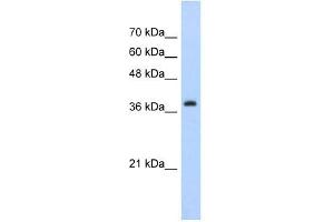 Western Blot showing CBX6 antibody used at a concentration of 1-2 ug/ml to detect its target protein. (CBX6 antibody  (C-Term))