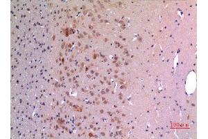 Immunohistochemistry (IHC) analysis of paraffin-embedded Rat Brain, antibody was diluted at 1:100. (GDF5 antibody  (Internal Region))