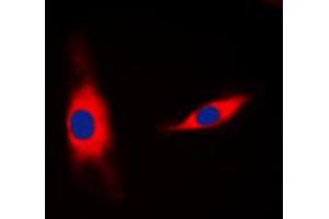 Immunofluorescent analysis of 14-3-3 eta staining in MCF7 cells. (14-3-3 eta antibody  (Center))