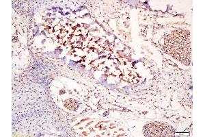 Formalin-fixed and paraffin embedded mouse embryonic bone labeled with Anti-Osteocalcin Polyclonal Antibody, Unconjugated (ABIN669036) at 1:200 followed by conjugation to the secondary antibody and DAB staining (Osteocalcin antibody  (AA 21-80))