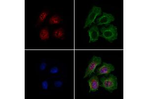ABIN7094787 and ABIN7098838 staining HepG2 cells by IF/ICC. (DCP2 antibody  (Internal Region))