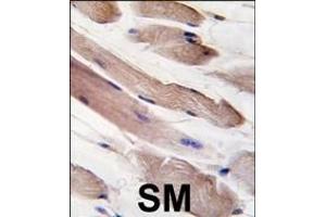 Immunohistochemistry (Paraffin-embedded Sections) (IHC (p)) image for anti-Phosphoinositide 3 Kinase, p85 alpha (PI3K p85a) (AA 558-587) antibody (ABIN392572)