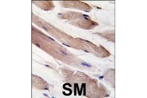 Formalin-fixed and paraffin-embedded human skeletal muscle tissue reacted with PIK3R1-p, which was peroxidase-conjugated to the secondary antibody, followed by DAB staining. (PIK3R1 antibody  (AA 558-587))