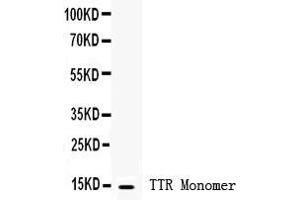 Anti- Prealbumin Picoband antibody, Western blottingAll lanes: Anti Prealbumin  at 0. (TTR antibody  (AA 21-147))