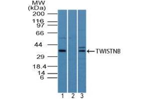 Image no. 1 for anti-TWIST Neighbor (TWISTNB) (AA 50-100) antibody (ABIN960391) (TWIST Neighbor antibody  (AA 50-100))