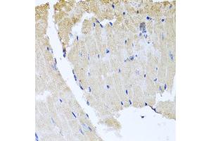Immunohistochemistry of paraffin-embedded mouse heart using RAB24 antibody at dilution of 1:100 (x40 lens).