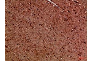 Immunohistochemical analysis of paraffin-embedded Human-brain, antibody was diluted at 1:100 (EYA1 antibody)