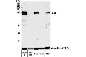 Western Blotting (WB) image for anti-AXL Receptor tyrosine Kinase (AXL) (AA 33-440) antibody (ABIN7453376) (Recombinant AXL antibody  (AA 33-440))