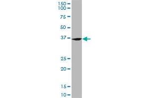 FZR1 monoclonal antibody (M02), clone 4C4. (FZR1 antibody  (AA 1-493))