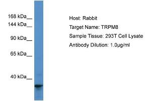 Host: Rabbit Target Name: TRPM8 Sample Type: 293T Whole Cell lysates Antibody Dilution: 1. (TRPM8 antibody  (N-Term))