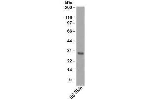 Western blot testing of human samples using Bcl-2 antibody (124). (Bcl-2 antibody  (AA 41-54))