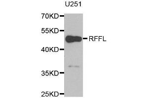 Western blot analysis of extracts of U251 cell line, using RFFL antibody. (RFFL antibody)