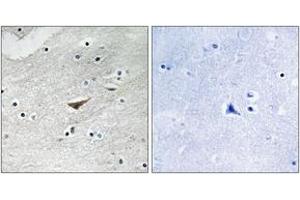 Immunohistochemistry analysis of paraffin-embedded human brain, using VE-Cadherin (Phospho-Tyr731) Antibody. (Cadherin 5 antibody  (pTyr731))