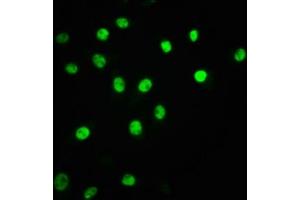 Immunofluorescence staining of A549 cells(treated with 100 mM EGF for 20 min) with ABIN7127679 at 1:63,counter-stained with DAPI. (Recombinant ATF2 antibody  (Thr71))