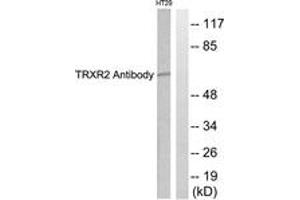 Western blot analysis of extracts from HT29 cells, using TRXR2 Antibody.