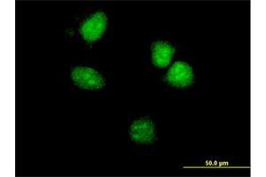 Immunofluorescence of monoclonal antibody to HOXA5 on HeLa cell. (HOXA5 antibody  (AA 171-270))