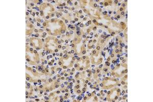 Immunohistochemistry of paraffin-embedded rat kidney using MonoMethyl-Histone H3-K4 antibody (ABIN1872994) at dilution of 1:200 (40x lens). (Histone 3 antibody  (H3K4me))