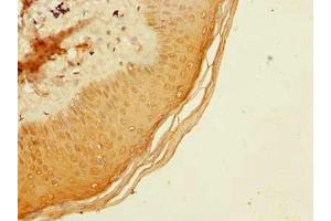 Immunohistochemistry of paraffin-embedded human skin tissue using ABIN7173532 at dilution of 1:100 (ADAT1 antibody  (AA 1-501))
