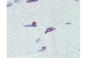 PRDM9 antibody  (AA 431-480)