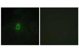 Immunofluorescence (IF) image for anti-Cytochrome P450, Family 2, Subfamily E, Polypeptide 1 (CYP2E1) (C-Term) antibody (ABIN1850358) (CYP2E1 antibody  (C-Term))