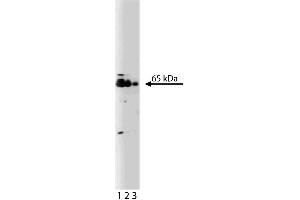 Western blot analysis of TLS on a Jurkat cell lysate. (FUS antibody  (AA 2-117))