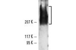 Western blot analysis of TRA-1-81 expression using TRA-1-81 monoclonal antibody, clone TRA-1-81  in NTERA-2 cl. (TRA1-81 antibody)