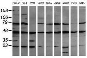 Image no. 1 for anti-Mitogen-Activated Protein Kinase Kinase 1 (MAP2K1) antibody (ABIN1499374) (MEK1 antibody)