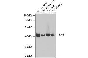 Western blot analysis of extracts of various cell lines using FAH Polyclonal Antibody at dilution of 1:1000. (FAH antibody)