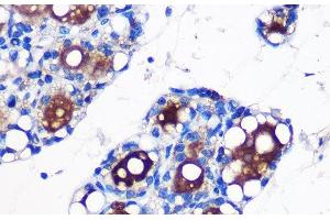 Immunohistochemistry of paraffin-embedded Rat fat using UCP1 Polyclonal Antibody at dilution of 1:100 (40x lens). (UCP1 antibody)