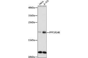 Western blot analysis of extracts of various cell lines, using PPP1R14B antibody (ABIN7269675) at 1:1000 dilution.